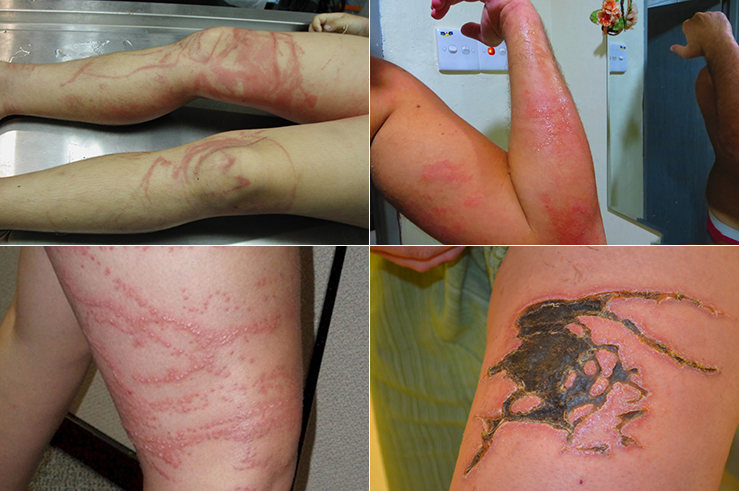 Сезон медуз в Тунисе Сезон медуз в Тунисе